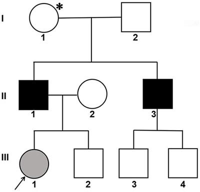 The First COL4A5 Exon 41A Glycine Substitution in a Family With Alport Syndrome